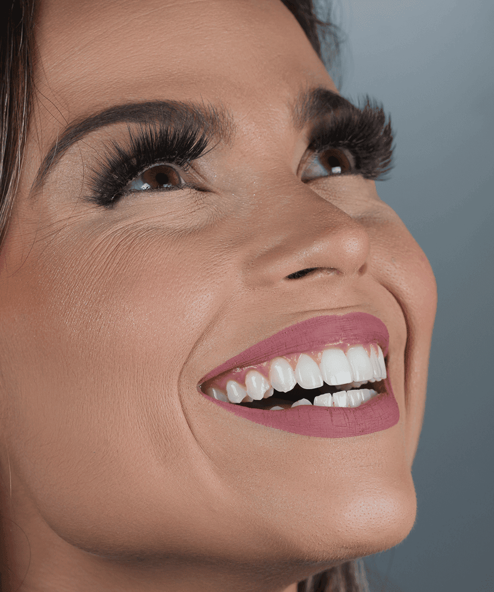 Sorriso com lentes de contato dental, Instituto Joie Botelhos