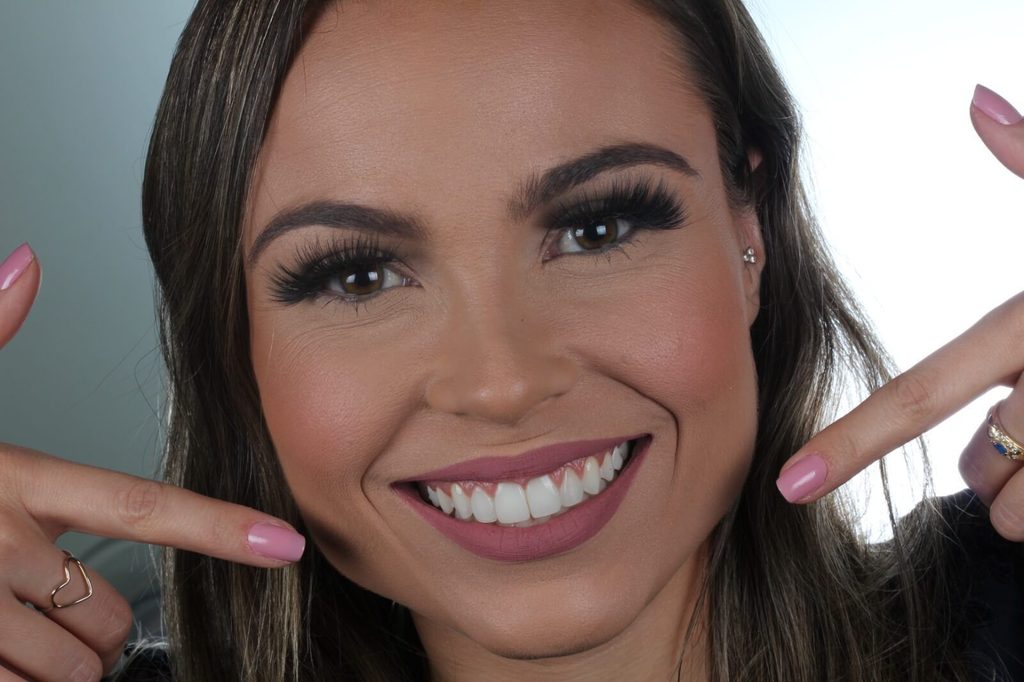 Paciente sorrindo e apontando para os dentes após tratamento com facetas dentárias em Botelhos - MG